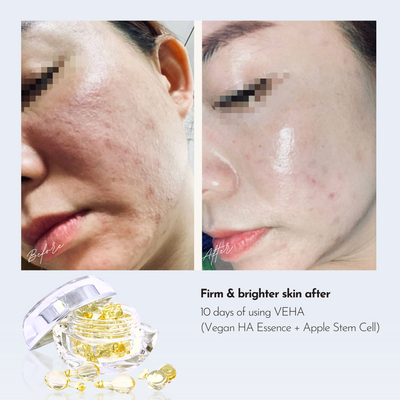 [qaleR Cosmetic] VEHA 1ST TRIAL (10 Days) | Vegan HA Essence + Apple Stem Cell - Hydration, Repair, Anti-aging