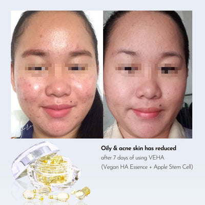 [qaleR Cosmetic] VEHA 1ST TRIAL (10 Days) | Vegan HA Essence + Apple Stem Cell - Hydration, Repair, Anti-aging